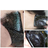 Face-Mask Blackhead Remover - EvoltOne