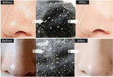 Face-Mask Blackhead Remover - EvoltOne