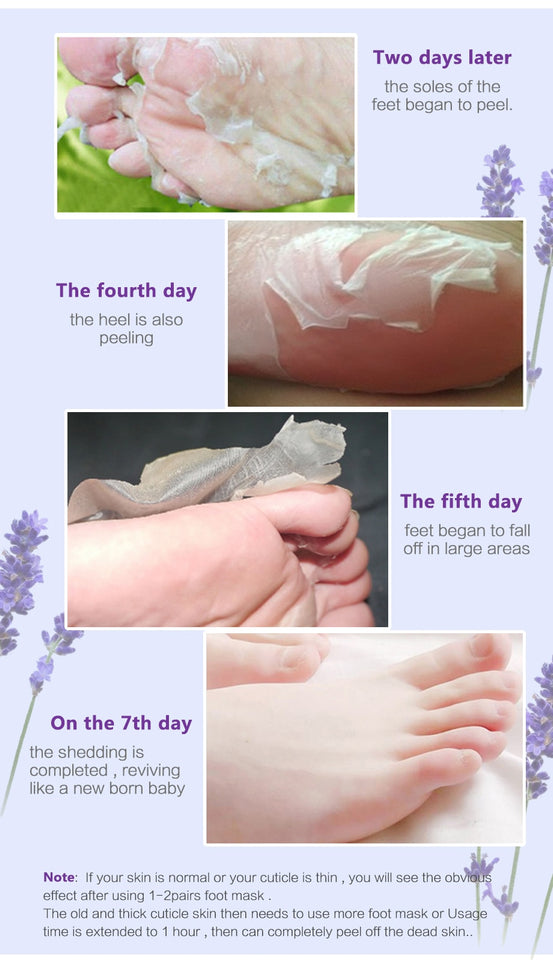 Feet Mask Remove Dead Skin - EvoltOne