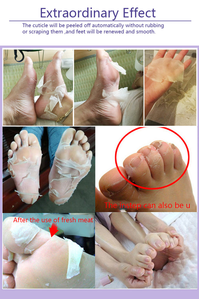 Feet Mask Remove Dead Skin - EvoltOne