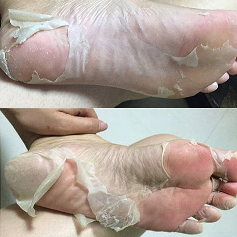 Feet Mask Remove Dead Skin - EvoltOne